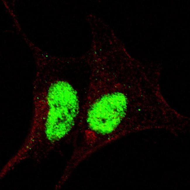 SOX2 Antibody - Fluorescent confocal image of SY5Y cells stained with phospho-Sox2- S246 antibody. SY5Y cells were fixed with 4% PFA (20 min), permeabilized with Triton X-100 (0.2%, 30 min). Cells were then incubated phospho-Sox2- S246 primary antibody (1:200, 2 h at room temperature). For secondary antibody, Alexa Fluor 488 conjugated donkey anti-rabbit antibody (green) was used (1:1000, 1h). Nuclei were counterstained with Hoechst 33342 (blue) (10 ug/ml, 5 min). Note the highly specific localization of the phospho-Sox2 immunosignal mainly to the nucleus.