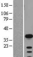 SOX2 Protein - Western validation with an anti-DDK antibody * L: Control HEK293 lysate R: Over-expression lysate