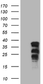 SOX21 Antibody - HEK293T cells were transfected with the pCMV6-ENTRY control. (Left lane) or pCMV6-ENTRY SOX21. (Right lane) cDNA for 48 hrs and lysed. Equivalent amounts of cell lysates. (5 ug per lane) were separated by SDS-PAGE and immunoblotted with anti-SOX21. (1:2000)