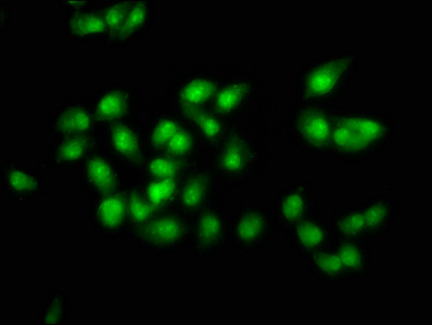 SOX21 Antibody - Immunofluorescence staining of ntera-2 at a dilution of 1:100, counter-stained with DAPI. The cells were fixed in 4% formaldehyde, permeabilized using 0.2% Triton X-100 and blocked in 10% normal Goat Serum. The cells were then incubated with the antibody overnight at 4 °C.The secondary antibody was Alexa Fluor 488-congugated AffiniPure Goat Anti-Rabbit IgG (H+L) .