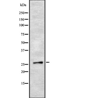 SOX21 Antibody - Western blot analysis SOX21 using HepG2 whole cells lysates
