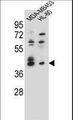 SOX3 Antibody - SOX3 Antibody western blot of MDA-MB453,HL-60 cell line lysates (35 ug/lane). The SOX3 antibody detected the SOX3 protein (arrow).