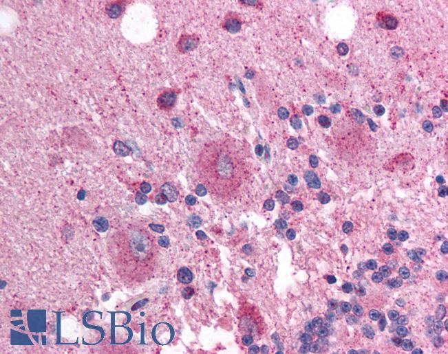 SOX3 Antibody - Anti-SOX3 antibody IHC of human brain, cerebellum. Immunohistochemistry of formalin-fixed, paraffin-embedded tissue after heat-induced antigen retrieval. Antibody concentration 5 ug/ml.  This image was taken for the unconjugated form of this product. Other forms have not been tested.
