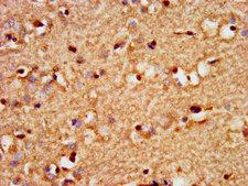 SOX3 Antibody - Immunohistochemistry image at a dilution of 1:300 and staining in paraffin-embedded human brain tissue performed on a Leica BondTM system. After dewaxing and hydration, antigen retrieval was mediated by high pressure in a citrate buffer (pH 6.0) . Section was blocked with 10% normal goat serum 30min at RT. Then primary antibody (1% BSA) was incubated at 4 °C overnight. The primary is detected by a biotinylated secondary antibody and visualized using an HRP conjugated SP system.