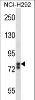 SOX30 Antibody - SOX30 Antibody western blot of NCI-H292 cell line lysates (35 ug/lane). The SOX30 antibody detected the SOX30 protein (arrow).