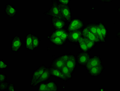 SOX30 Antibody - Immunofluorescence staining of HepG2 cells diluted at 1:133, counter-stained with DAPI. The cells were fixed in 4% formaldehyde, permeabilized using 0.2% Triton X-100 and blocked in 10% normal Goat Serum. The cells were then incubated with the antibody overnight at 4°C.The Secondary antibody was Alexa Fluor 488-congugated AffiniPure Goat Anti-Rabbit IgG (H+L).