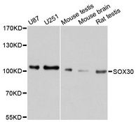 SOX30 Antibody - Western blot analysis of extracts of various cell lines, using SOX30 antibody at 1:1000 dilution. The secondary antibody used was an HRP Goat Anti-Rabbit IgG (H+L) at 1:10000 dilution. Lysates were loaded 25ug per lane and 3% nonfat dry milk in TBST was used for blocking. An ECL Kit was used for detection and the exposure time was 10s.