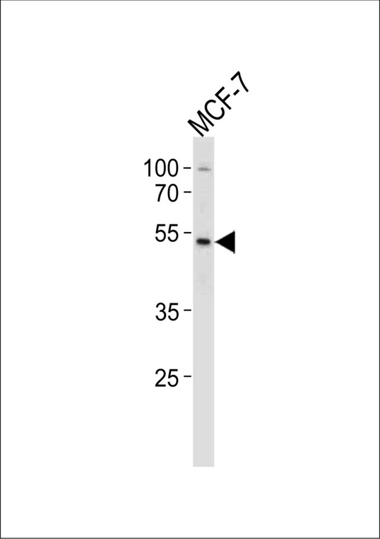 SOX4 Antibody - SOX4 Antibody western blot of MCF-7 cell line lysates (35 ug/lane). The SOX4 antibody detected the SOX4 protein (arrow).