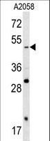 SOX4 Antibody - Western blot of SOX4 antibody in A2058 cell line lysates (35 ug/lane). SOX4 (arrow) was detected using the purified antibody.