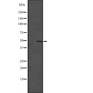 SOX4 Antibody - Western blot analysis of SOX4 expression in HeLa cells lysate. The lane on the left is treated with the antigen-specific peptide.