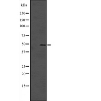 SOX4 Antibody - Western blot analysis of SOX4 expression in HeLa cells lysate. The lane on the left is treated with the antigen-specific peptide.