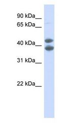 SOX4 Antibody - SOX4 antibody Western Blot of Fetal kidney lysate.  This image was taken for the unconjugated form of this product. Other forms have not been tested.
