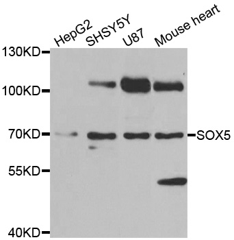SOX5 Antibody - Western blot analysis of extracts of various cell lines.