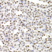 SOX5 Antibody - Immunohistochemistry of paraffin-embedded rat kidney tissue.
