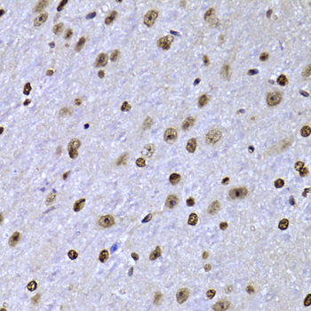 SOX5 Antibody - Immunohistochemistry of paraffin-embedded mouse brain tissue.