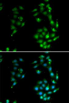 SOX5 Antibody - Immunofluorescence analysis of U20S cells.