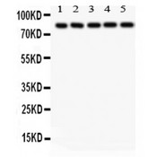 SOX5 Antibody - SOX5 antibody, PBSOX5, Western blot. All lanes: Anti SOX5 at 0.5 ug/ml. Lane 1: Rat Liver Tissue Lysate at 50 ug. Lane 2: Rat Testis Tissue Lysate at 50 ug. Lane 3: Rat Brain Tissue Lysate at 50 ug. Lane 4: HELA Whole Cell Lysate at 40 ug. Lane 5: A549 Whole Cell Lysate at 40 ug. Predicted band size: 84 kD. Observed band size: 84 kD.