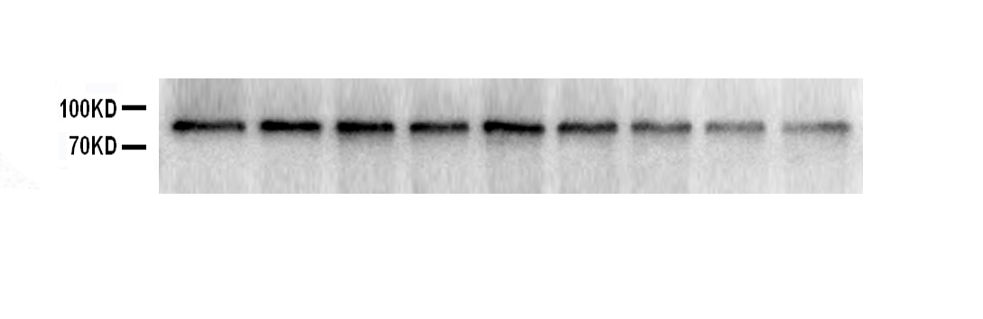 SOX5 Antibody - Western blot analysis of SOX5 using anti-SOX5 antibody. Electrophoresis was performed on a 5-20% SDS-PAGE gel at 70V (Stacking gel) / 90V (Resolving gel) for 2-3 hours. The sample well of each lane was loaded with 40ug of sample under reducing conditions. All lanes: pig adipose cellsAfter Electrophoresis, proteins were transferred to a Nitrocellulose membrane at 150mA for 50-90 minutes. Blocked the membrane with 5% Non-fat Milk/ TBS for 1.5 hour at RT. The membrane was incubated with rabbit anti-SOX5 antigen affinity purified polyclonal antibody at 0.5 µg/mL overnight at 4°C, then washed with TBS-0.1% Tween 3 times with 5 minutes each and probed with a goat anti-rabbit IgG-HRP secondary antibody at a dilution of 1:10000 for 1.5 hour at RT. The signal is developed using an Enhanced Chemiluminescent detection (ECL) kit with Tanon 5200 system. A specific band was detected for SOX5 at approximately 84KD. The expected band size for SOX5 is at 84KD.