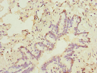 SOX5 Antibody - Immunohistochemistry of paraffin-embedded human lung tissue at dilution 1:100