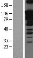 SOX5 Protein - Western validation with an anti-DDK antibody * L: Control HEK293 lysate R: Over-expression lysate