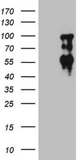 SOX6 Antibody - HEK293T cells were transfected with the pCMV6-ENTRY control. (Left lane) or pCMV6-ENTRY SOX6. (Right lane) cDNA for 48 hrs and lysed. Equivalent amounts of cell lysates. (5 ug per lane) were separated by SDS-PAGE and immunoblotted with anti-SOX6. (1:1000)(1:2000)