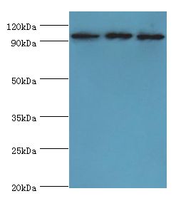 SOX6 Antibody - Western blot. All lanes: SOX6 antibody at 10 ug/ml. Lane 1: Jurkat whole cell lysate. Lane 2: HeLa whole cell lysate. Lane 3: 293T whole cell lysate. Secondary antibody: Goat polyclonal to rabbit at 1:10000 dilution. Predicted band size: 92 kDa. Observed band size: 92 kDa.