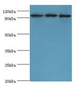 SOX6 Antibody - Western blot. All lanes: SOX6 antibody at 10 ug/ml. Lane 1: Jurkat whole cell lysate. Lane 2: HeLa whole cell lysate. Lane 3: 293T whole cell lysate. Secondary antibody: Goat polyclonal to rabbit at 1:10000 dilution. Predicted band size: 92 kDa. Observed band size: 92 kDa.