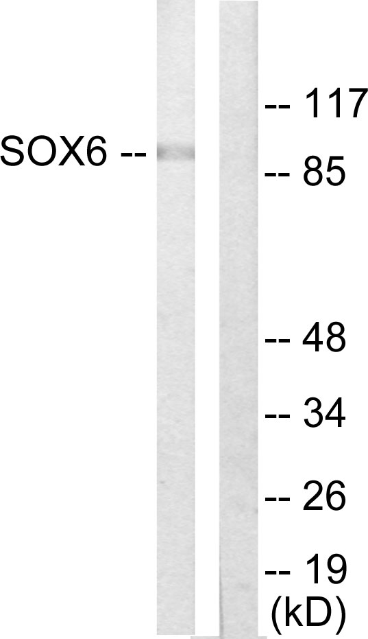 SOX6 Antibody - Western blot analysis of lysates from Jurkat cells, using SOX6 Antibody. The lane on the right is blocked with the synthesized peptide.