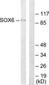 SOX6 Antibody - Western blot analysis of lysates from Jurkat cells, using SOX6 Antibody. The lane on the right is blocked with the synthesized peptide.
