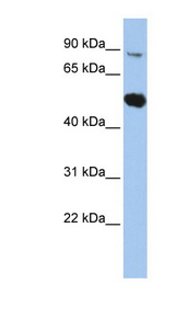 SOX6 Antibody - SOX6 antibody Western blot of HepG2 cell lysate. This image was taken for the unconjugated form of this product. Other forms have not been tested.