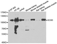 SOX6 Antibody - Western blot analysis of extracts of various cell lines.