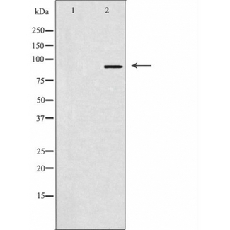 SOX6 Antibody - Western blot analysis of SOX6 antibody expression in HeLa cells lysates. The lane on the left is treated with the antigen-specific peptide.