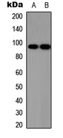 SOX6 Antibody - Western blot analysis of SOX6 expression in HEK293T (A); Jurkat (B) whole cell lysates.