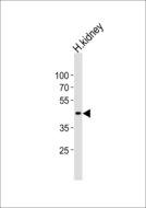 SOX7 Antibody - Western blot of lysate from human kidney tissue lysate, using SOX7 antibody diluted at 1:1000. A goat anti-rabbit IgG H&L (HRP) at 1:10000 dilution was used as the secondary antibody. Lysate at 20 ug.