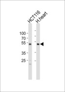 SOX7 Antibody - Western blot of lysates from HCT116 cell line and human heart tissue (from left to right), using SOX7 antibody diluted at 1:1000 at each lane. A goat anti-rabbit IgG H&L (HRP) at 1:10000 dilution was used as the secondary antibody. Lysates at 20 ug per lane.