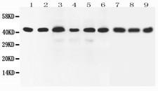 SOX7 Antibody - WB of SOX7 antibody. All lanes: Anti-SOX7 at 0.5ug/ml. Lane 1: Rat Brain Tissue Lysate at 40ug. Lane 2: Human Placenta Tissue Lysate at 40ug. Lane 3: Rat Lung Tissue Lysate at 40ug. Lane 4: Rat Testis Tissue Lysate at 40ug. Lane 5: HELA Whole Cell Lysate at 40ug. Lane 6: A549 Whole Cell Lysate at 40ug. Lane 7: HEPG2 Whole Cell Lysate at 40ug. Lane 8: SMMC Whole Cell Lysate at 40ug. Lane 9: NEURO Whole Cell Lysate at 40ug. Predicted bind size: 42KD. Observed bind size: 42KD.