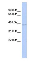 SOX7 Antibody - SOX7 antibody Western Blot of Fetal Stomach cell lysate.  This image was taken for the unconjugated form of this product. Other forms have not been tested.
