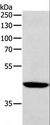 SOX7 Antibody - Western blot analysis of Human lymphoma tissue, using SOX7 Polyclonal Antibody at dilution of 1:1100.