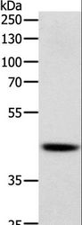 SOX7 Antibody - Western blot analysis of Human lymphoma tissue, using SOX7 Polyclonal Antibody at dilution of 1:750.