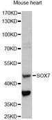 SOX7 Antibody - Western blot analysis of extracts of mouse heart, using SOX7 antibody at 1:1000 dilution. The secondary antibody used was an HRP Goat Anti-Rabbit IgG (H+L) at 1:10000 dilution. Lysates were loaded 25ug per lane and 3% nonfat dry milk in TBST was used for blocking. An ECL Kit was used for detection and the exposure time was 10s.