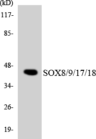 Sox8+9+17+18 Antibody - Western blot analysis of the lysates from HeLa cells using SOX8/9/17/18 antibody.