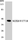 Sox8+9+17+18 Antibody - Western blot analysis of the lysates from HeLa cells using SOX8/9/17/18 antibody.