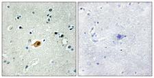 Sox8+9+17+18 Antibody - Immunohistochemistry analysis of paraffin-embedded human brain tissue, using SOX8/9/17/18 Antibody. The picture on the right is blocked with the synthesized peptide.