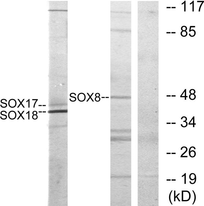 Sox8+9+17+18 Antibody - Western blot analysis of lysates from COS7 cells, treated with serum 10% 30', using SOX8/9/17/18 Antibody. The lane on the right is blocked with the synthesized peptide.