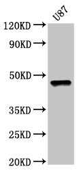 SOX8 Antibody - Positive Western Blot detected in U87 whole cell lysate. All lanes: SOX8 antibody at 5 µg/ml Secondary Goat polyclonal to rabbit IgG at 1/50000 dilution. Predicted band size: 48 KDa. Observed band size: 48 KDa