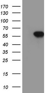SOX9 Antibody - HEK293T cells were transfected with the pCMV6-ENTRY control (Left lane) or pCMV6-ENTRY SOX9 (Right lane) cDNA for 48 hrs and lysed. Equivalent amounts of cell lysates (5 ug per lane) were separated by SDS-PAGE and immunoblotted with anti-SOX9.