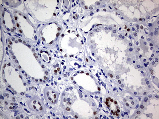 SOX9 Antibody - IHC of paraffin-embedded Human Kidney tissue using anti-SOX9 mouse monoclonal antibody. (Heat-induced epitope retrieval by 1 mM EDTA in 10mM Tris, pH9.0, 120°C for 3min).