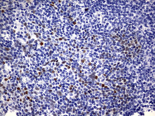 SOX9 Antibody - IHC of paraffin-embedded Human tonsil using anti-SOX9 mouse monoclonal antibody. (Heat-induced epitope retrieval by 1 mM EDTA in 10mM Tris, pH9.0, 120°C for 3min).