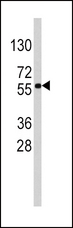SOX9 Antibody - Western blot of anti-SOX9 Antibody (RB13405) in HepG2 cell line lysates (35 ug/lane). SOX9(arrow) was detected using the purified antibody.