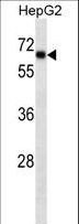 SOX9 Antibody - SOX9 Antibody western blot of HepG2 cell line lysates (35 ug/lane). The SOX9 antibody detected the SOX9 protein (arrow).